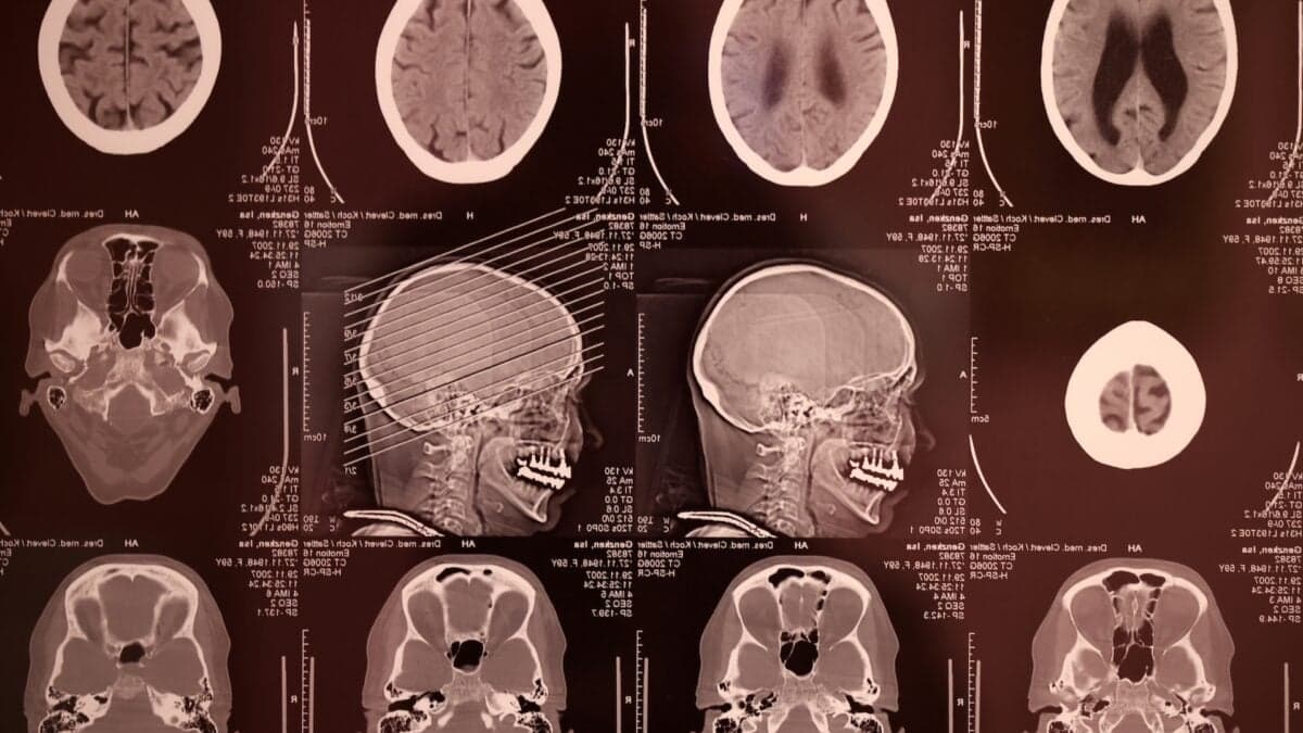 Meta's AI Is Getting Better at Reading Your Thoughts—Without Cracking Open Your Skull